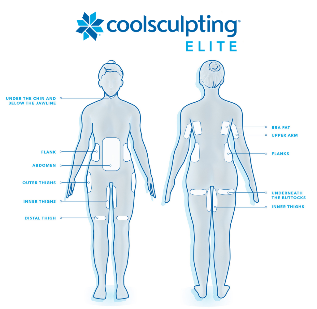 CoolSculpting