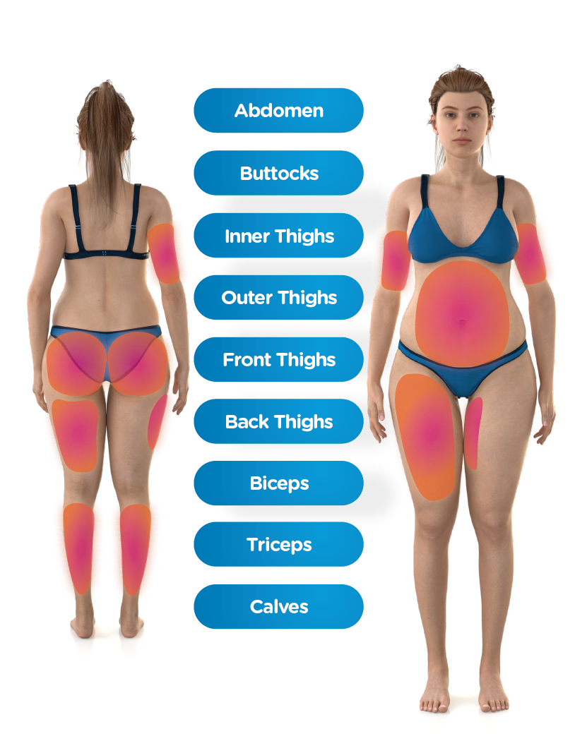 Emsculpt_Neo_PIC_Body-Parts-female_ENUS100 CoolSculpting