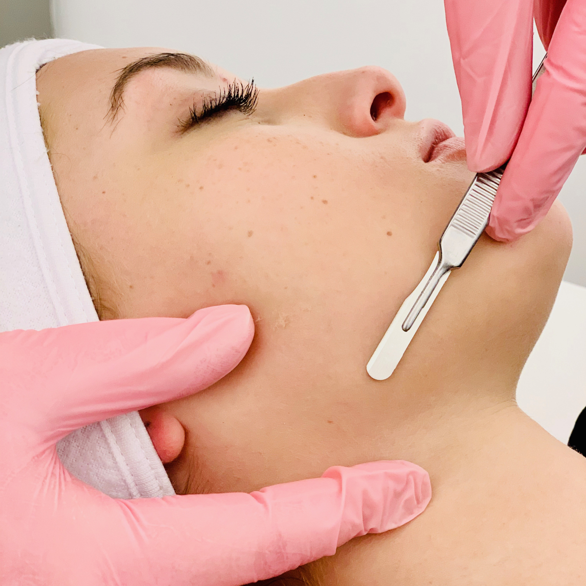 atalla-dermaplane-2020-web