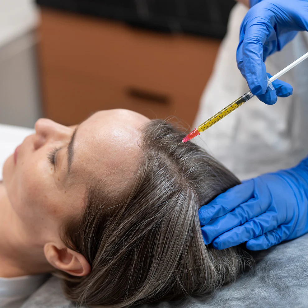 PRPHairRestoration CoolSculpting